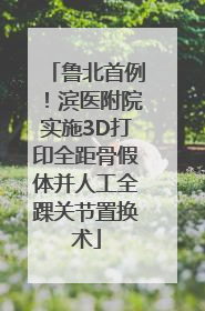 鲁北首例！滨医附院实施3D打印全距骨假体并人工全踝关节置换术
